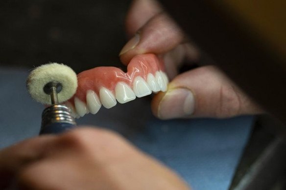 Tandprothesen - Dental Art work, Hasselt